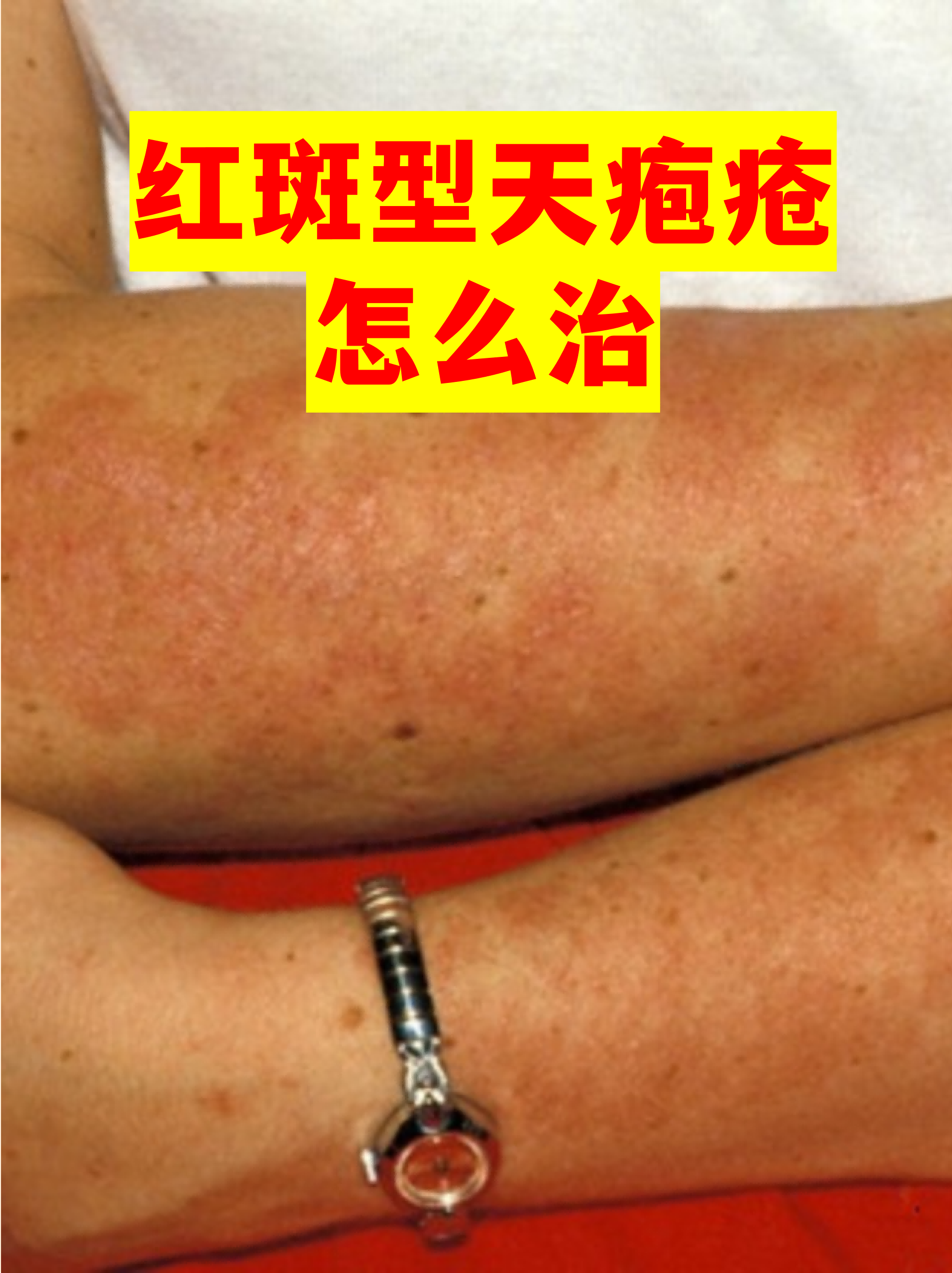 【四川新增省内感染者1050例/四川新增感染者的症状】-第1张图片