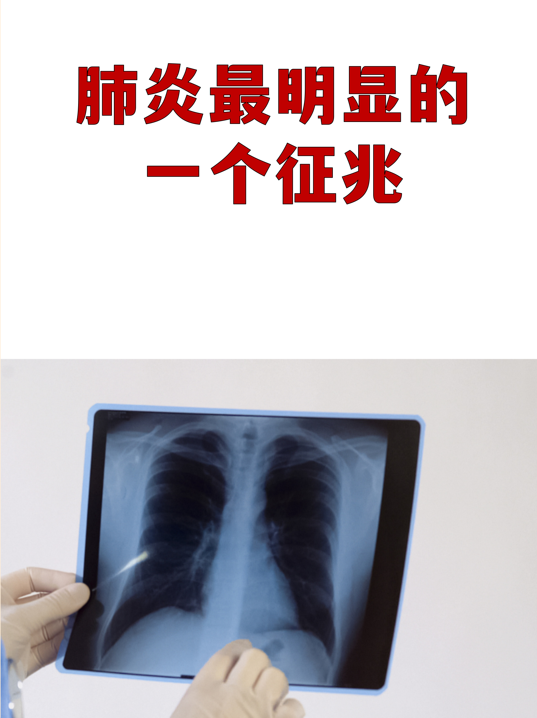 第2轮感染高峰预测.新冠疫情二次感染-第1张图片