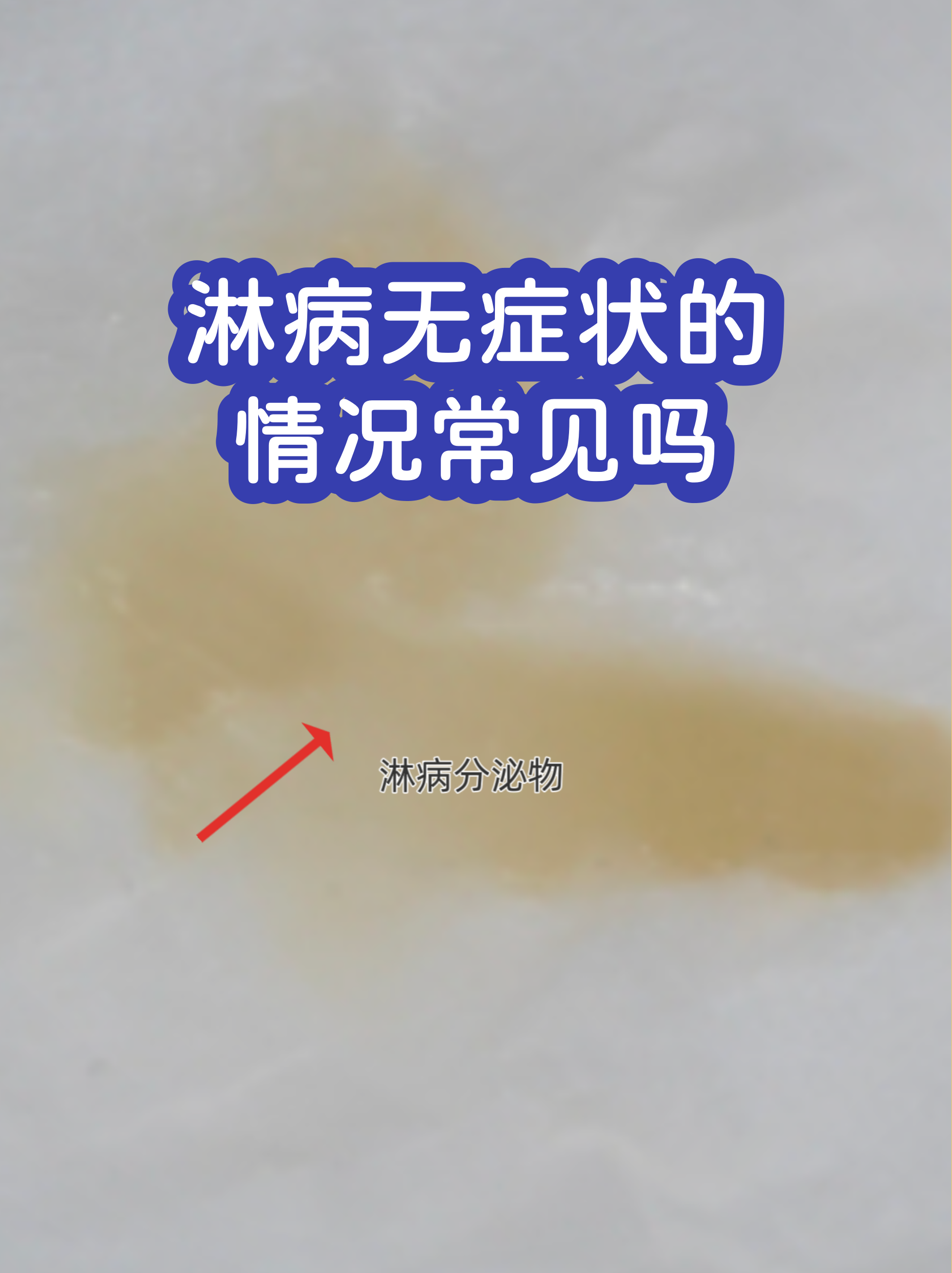 上海为何无症状较多?官方回应︰(上海无症状感染者有多少)-第1张图片