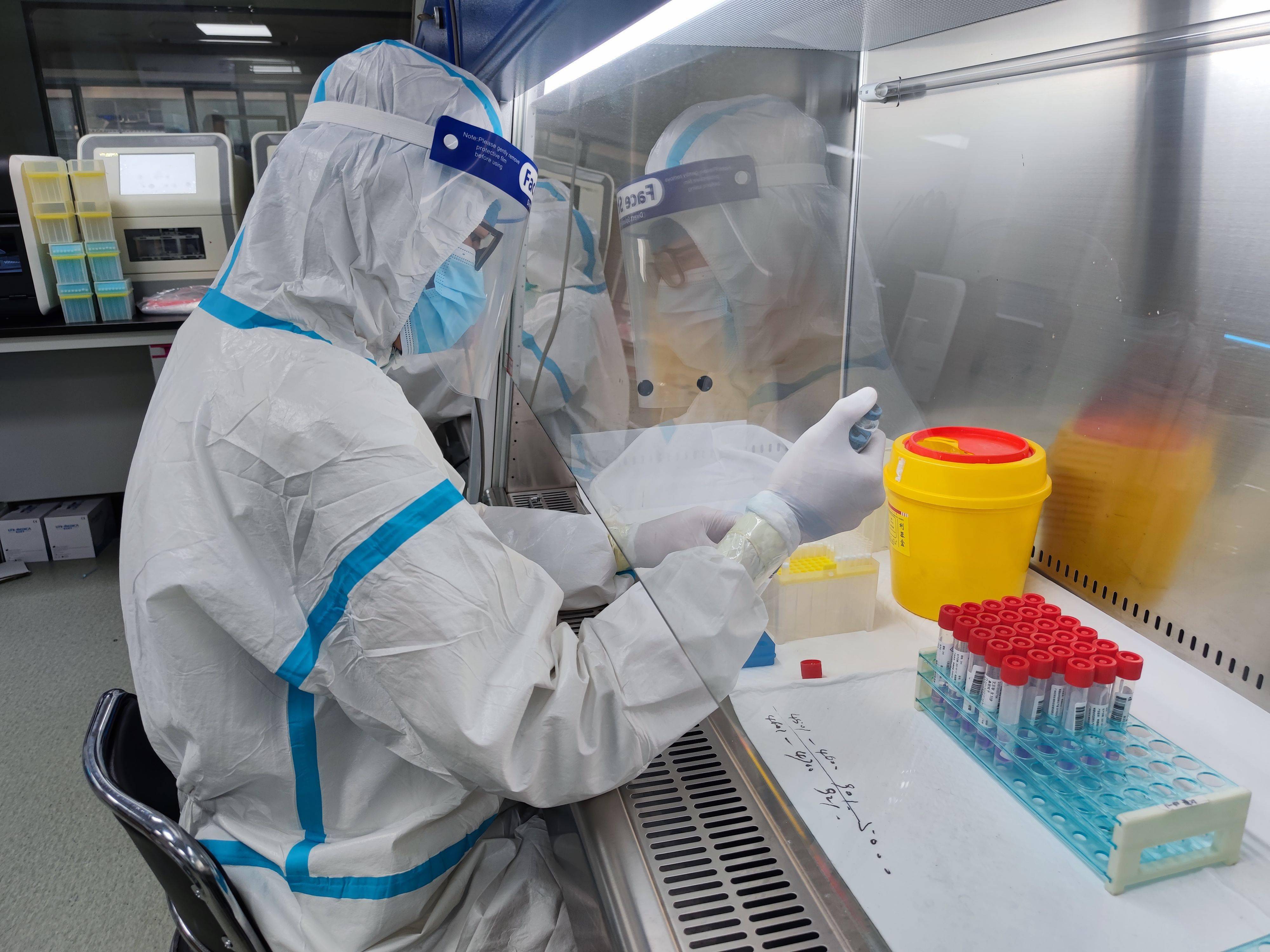 现在返乡要做核酸检测吗︰(现在返乡要做核酸检测吗最新消息)