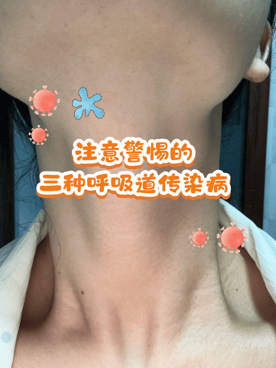 “最新新冠病毒” 最新新冠病毒感染什么症状？-第2张图片