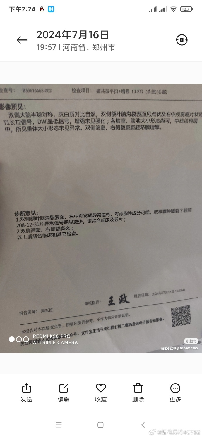 31省区市新增确诊28例,31省区市新增确诊病例27例-第1张图片