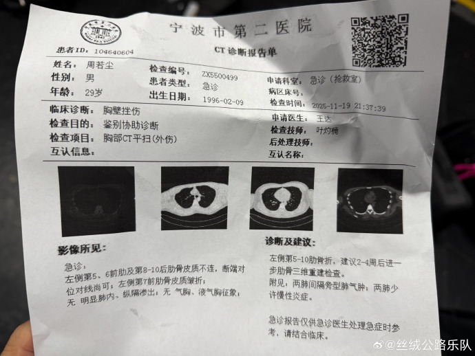 浙江昨日新增确诊病例38例〃浙江昨日新增确诊28例-第2张图片